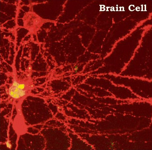 brain — noiron (newron / neuron)